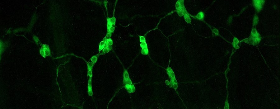 Enteric neurons, Submucosal Plexus (Rat, PGP9.5)