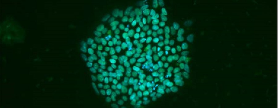 iPSC from esophageal atresia patient- SOX2